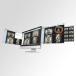 RayPlan <span>Treatment Planning System</span>